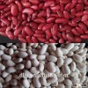 Chinese Kidney Beans ,Red and White Kidney Bean,Factory