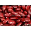 High Qualtiy Red , white and black Kidney Bean,340-350pcs/100g,Azuki Bean