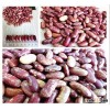 Best quality purple speckled kidney bean long shape cooking red kidney beans