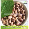 Light Speckled Kidney Beans American Type /Pinto Beans/Pulses