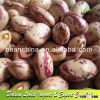 Light Speckled Kidney Beans Round Shape Light Sugar Beans,Pulses