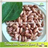 Non GMO Light Speckled Kidney Beans Long Shape/Pinto Beans