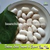 High Quality 2013 Crop Large White Kidney Beans Square Type