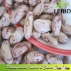 New crop Light Speckled Kidney Beans American Type /Pinto Beans/Pulses