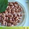 Light Speckled Kidney Beans Xinjiang Origin Or LSKB