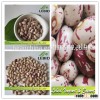 Price for Light Speckled Kidney Beans, Pinto Beans and Sugar beans