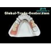 Distinguished Precision Denture Cast Partial Framework Titanium Material Easy Clean