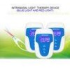 Red Light Intranasal Light Therapy For Chronic Rhinitis / Allergic Rhinitis / Nasal Issues