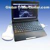 Ultrasound scanner laptop movable light easy to carry
