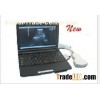 KR-2088Z Laptop Full Digital Ultrasound scanner