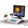 TR5000B Portable Infrared Mammary Diagnostic