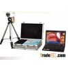 TR6000B Laptop portable Digital Electronic Colposcope