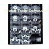8in* 10in 14in * 17in High Density Medical X-ray Dry Thermal Printer Film