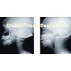 High Ink Coverage 35*43cm Medical x ray Paper Laser Printer Film