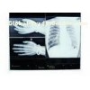 Low Fog 14in * 17in Medical Imaging Dry X-ray Transparency Thermal Printer Film