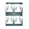13in * 17in Moisture Proof White Base Medical Paper Film For KONIDA Laser Printer