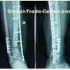 Medical Paper Laser Printer Film For Hospital Radiation Department