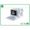 High Resolution CRT Monitor B Mode Ultrasound Scanner 10'' Multi - Language Ultrasonic Devic