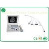 Smart Digital Colour Doppler Ultrasound CRT Stable Screen All Kinds Of Measurements