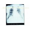 11in * 14in, Konida Medical paper Laser Imaging Film For KND-DRYTEC-3000