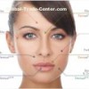 Facial Beauty Filler Hyaluronic Acid Filler