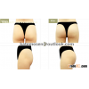 Hyaluronic Acid Dermal Filler For Buttock Augmentation