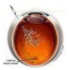 Non Cross Linked Medical Ophthalmic Sodium Hyaluronate Gel For Intraocular Injection