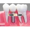 titanium dental implant screw
