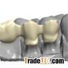 Porcelain Fused To Zirconia(PFZ)