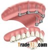 Implant Overdentures