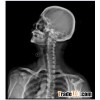 BRIGHTER DRY INKJET MEDICAL FILM