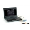 3000 Laptop Full Digital Ultrasound Scanner