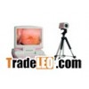 digital colposcope
