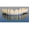 Zirconia Dental Crown  Zirconia Dental Lab in China